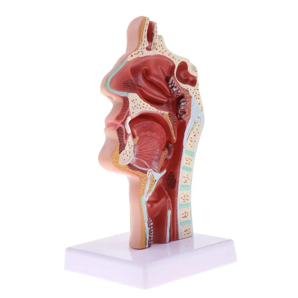 Modelo Anatômico Patologia da Garganta