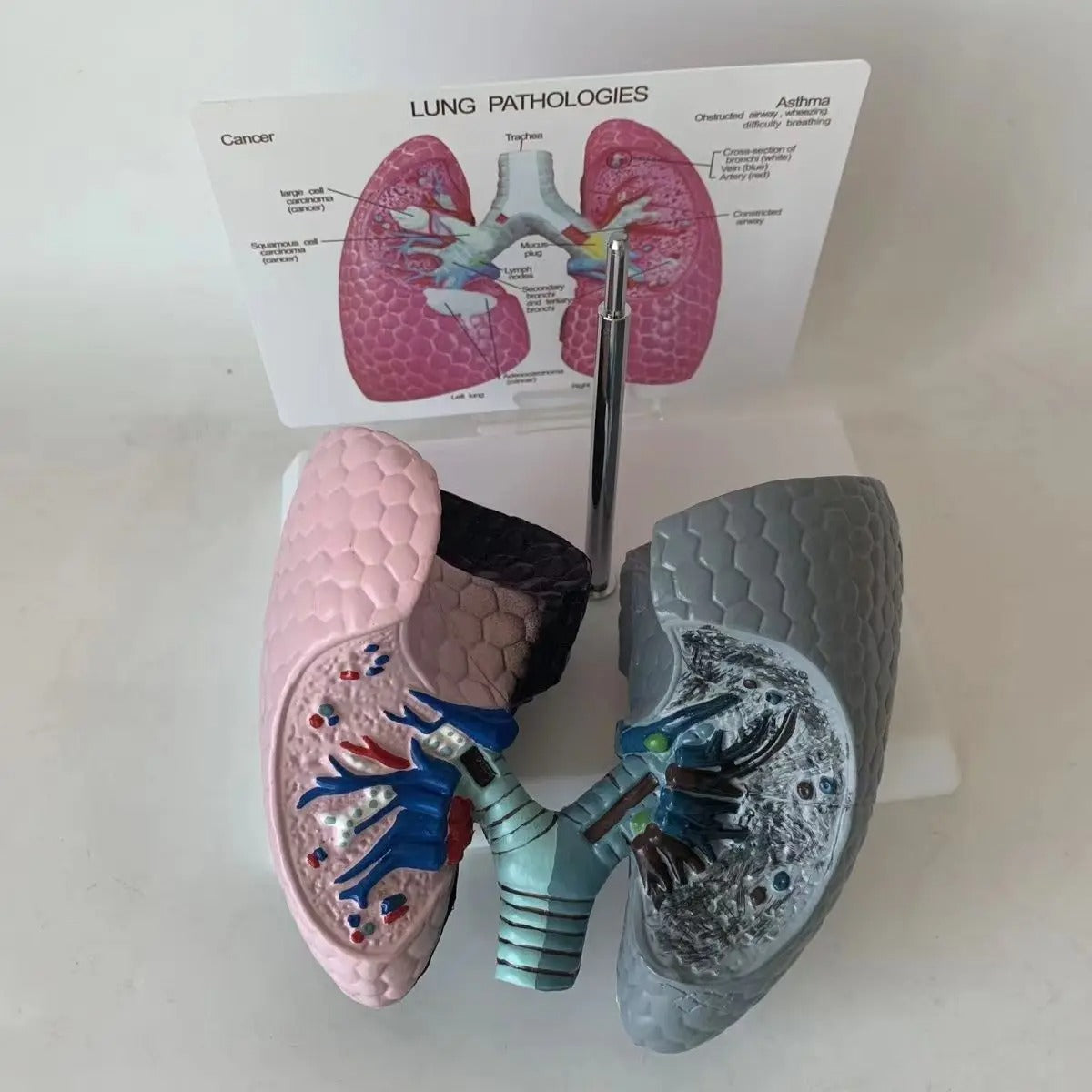 Modelo anatomico pulmao de fumante e saudável