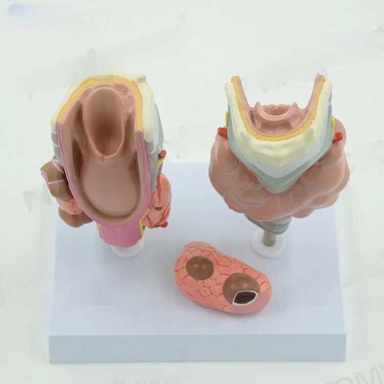 Modelo Anatômico Patologia da Tireóide: Hipertireoidismo