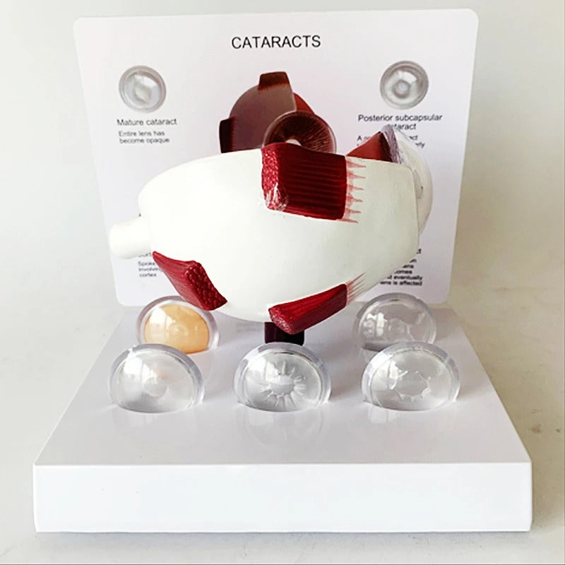 Modelo anatomico olho catarata