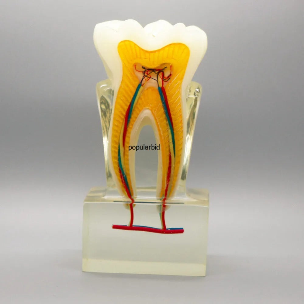 Modelo Ortodôntico com Base Clara – Demonstração de Dissecção Demoníaca (20:1 Dentes)
