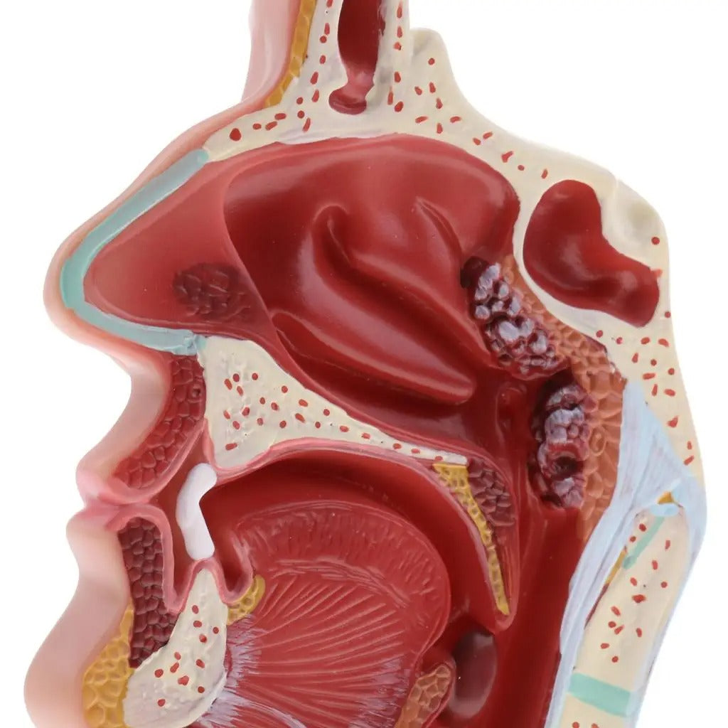 Modelo Anatômico Patologia da Garganta