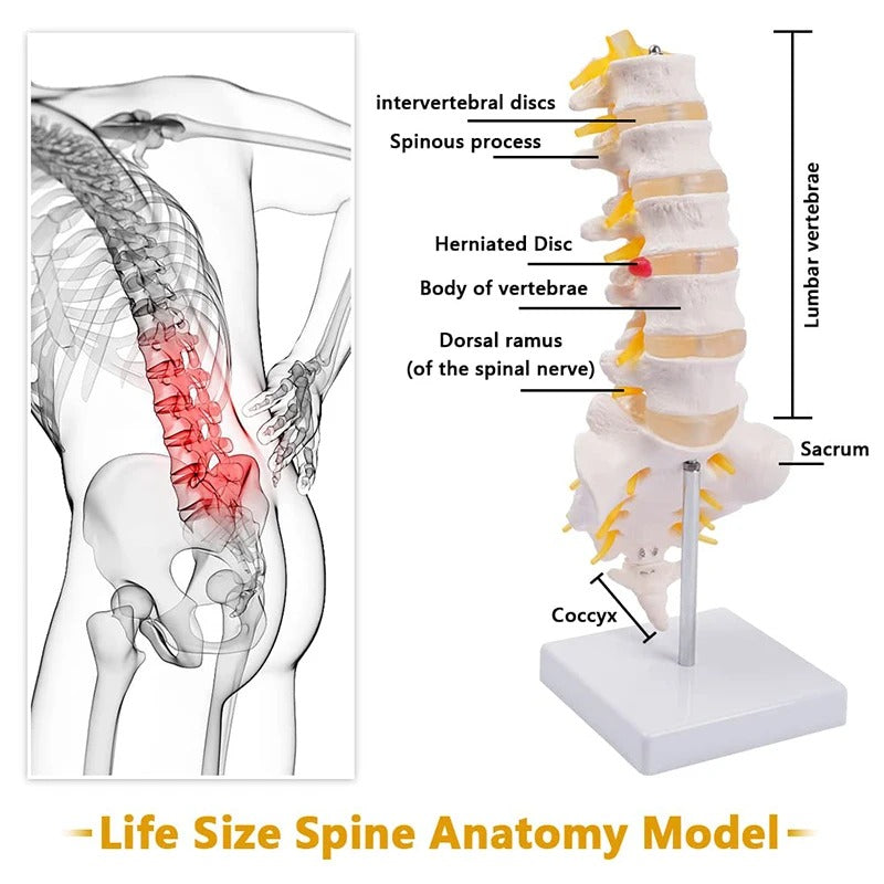 Modelo de Coluna Lombar em Tamanho Vital - Modelo de Anatomia