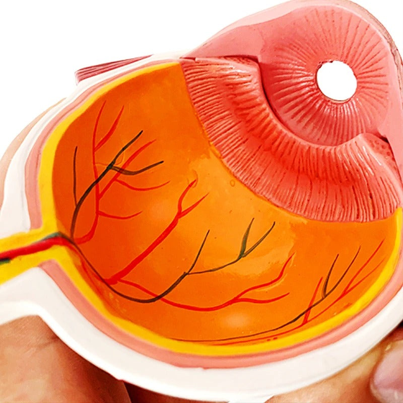 Modelo anatomico olho catarata