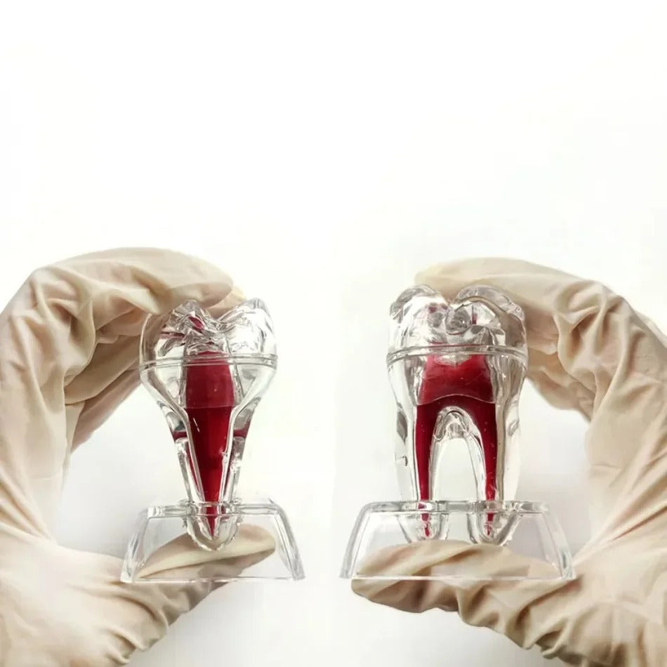 Modelo Anatômico Dental Destacável e Transparente – Luminoso e Único Dente