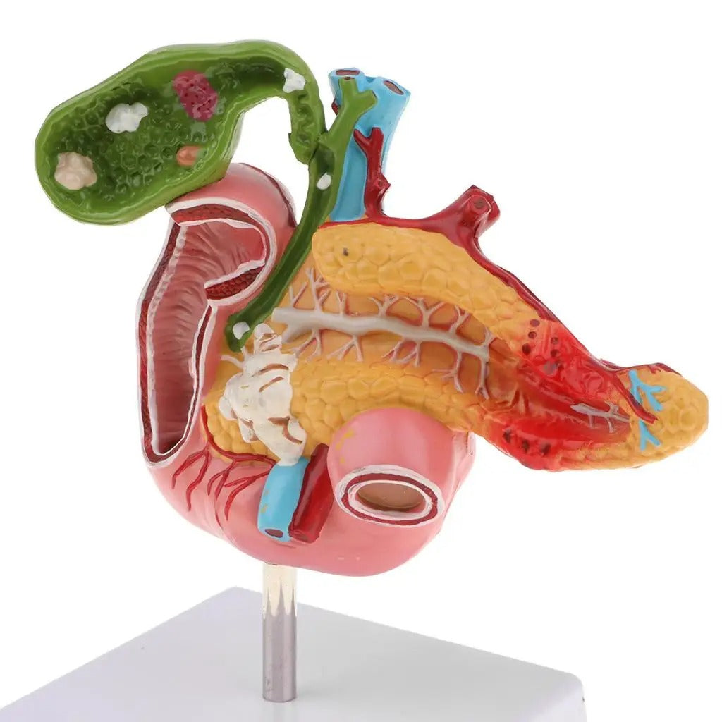 Modelo Anatomico Pancreas Duodeno