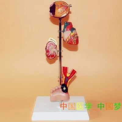 Modelo de Patologia de Diabetes