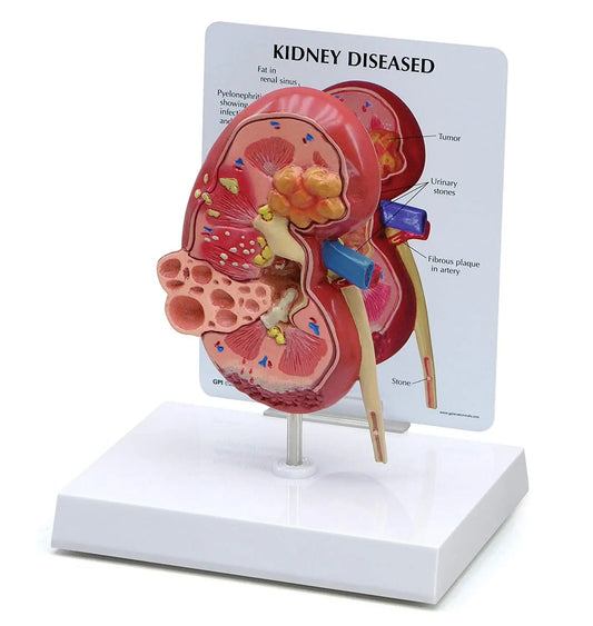 Modelo Anatomico Rim