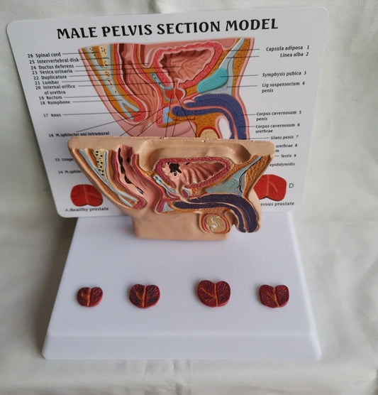 Modelo Anatômico da Pelve Masculina com Seção da Cavidade Abdominal, Bexiga e Próstata
