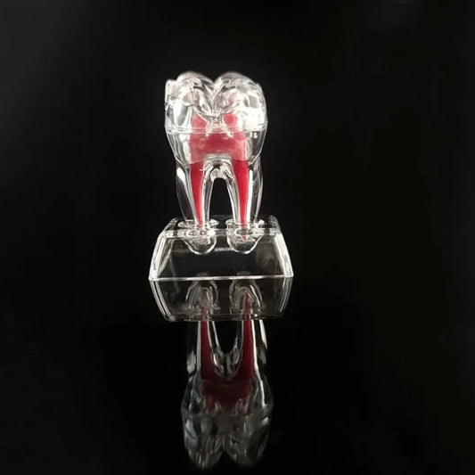 Modelo Anatômico Dental Destacável e Transparente – Luminoso e Único Dente