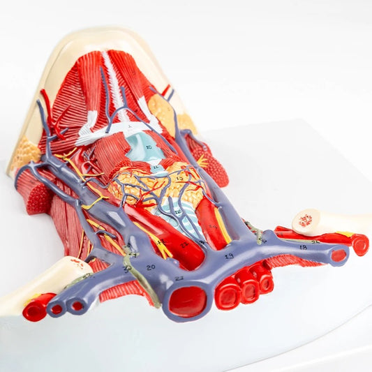 Modelo do Pescoço Arteriovenoso