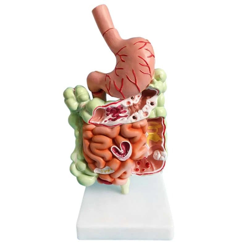 Modelo de Anatomia do Sistema Digestivo Humano - Estômago, Intestino, Reto e Duodeno