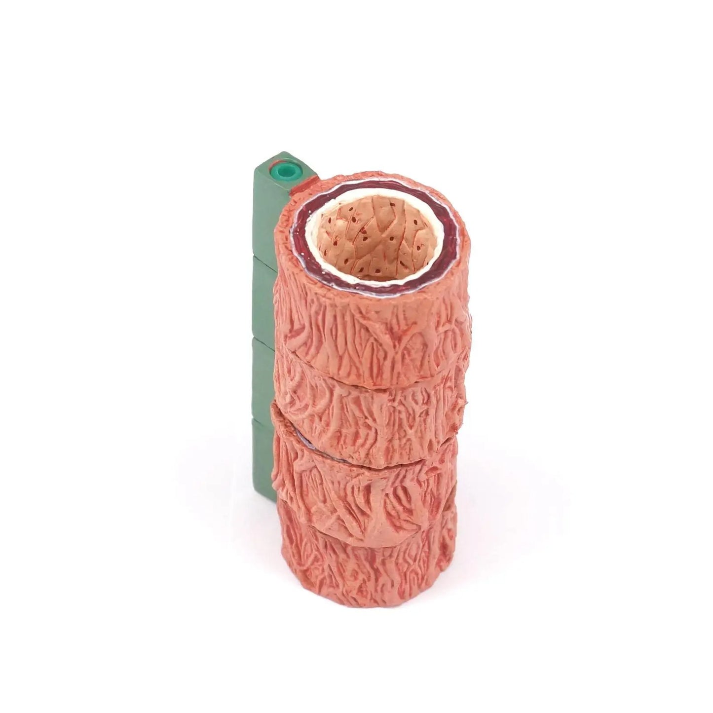 Modelo Anatômico Vascular com 4 Tipos: Normal, gordurosa, Placa e Estenose