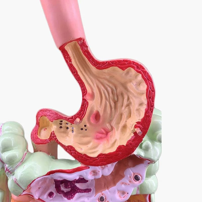 Modelo de Anatomia do Sistema Digestivo Humano - Estômago, Intestino, Reto e Duodeno