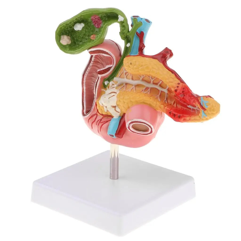 Modelo Anatomico Pancreas Duodeno