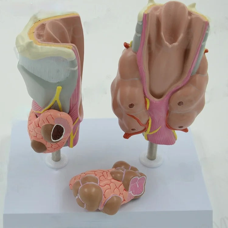 Modelo Anatômico Patologia da Tireóide: Hipertireoidismo