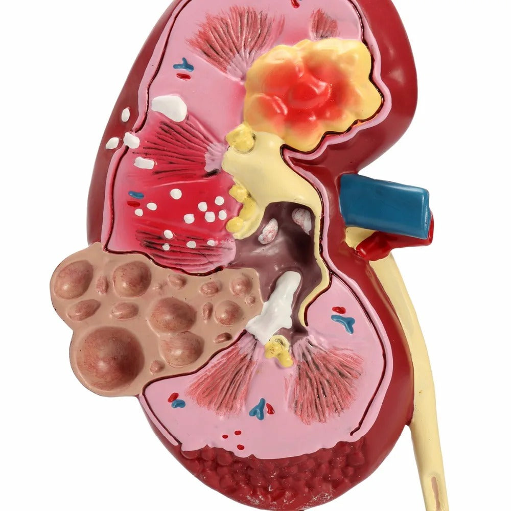 Modelo Anatomico Rim