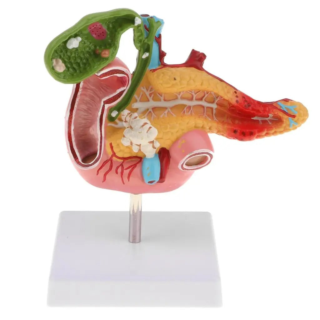 Modelo Anatomico Pancreas Duodeno