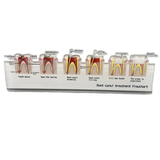 Fluxograma Suporte para Tratamento do Canal Radicular – Modelo de Ensino de Odontologia