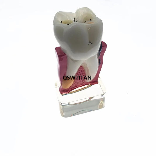 Modelo de Ensino Periodontal para Estudo – Demonstração Abrangente do Dente